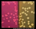 serratia marcescens on MacConkey agar and ENDO